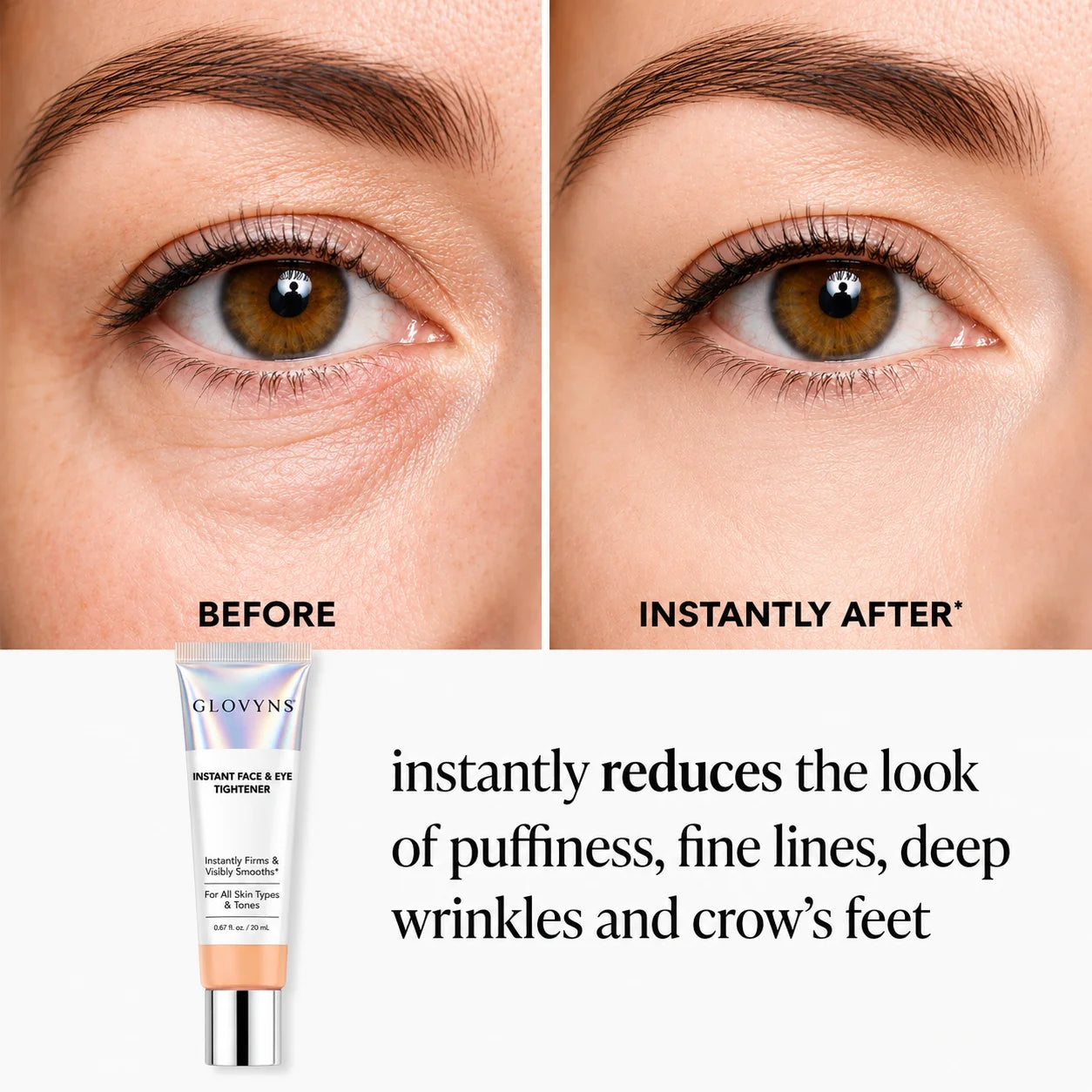GLOVYNS™ Instant Face Temporary Tightener – Instant visible results in 60 seconds